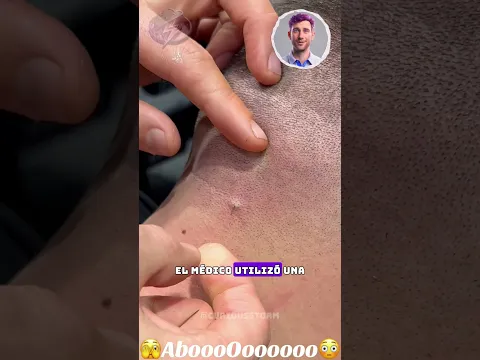🚨 El Motivo del Dolor Te Va a Sorprender ️⚠️🤯 #shorts