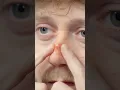 STOP POPPING THEM
