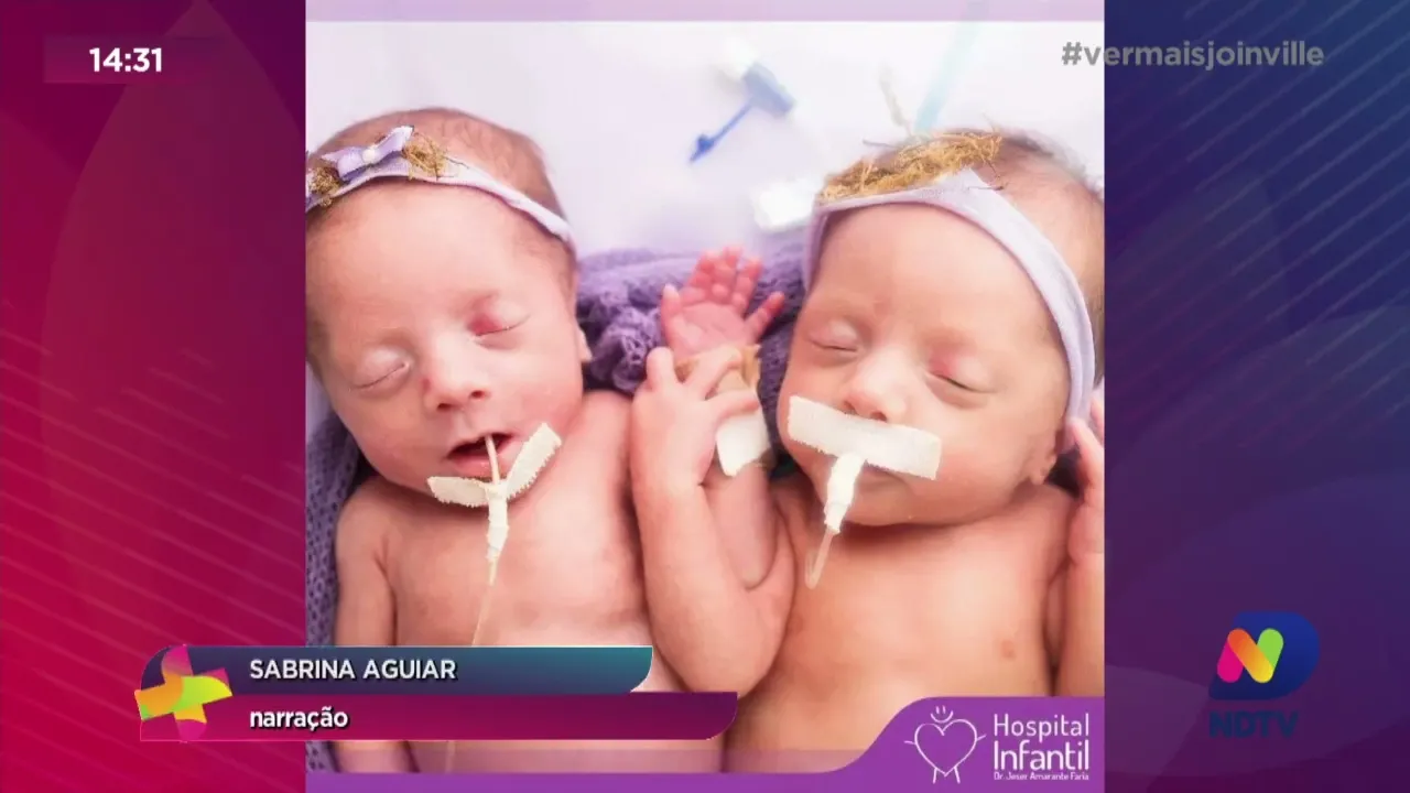 Bebês da UTI neonatal do Hospital Infantil ganham ensaio emocionante em Joinville