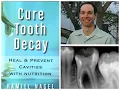 Author of Healing our Children and Cure Tooth Decay researcher and dental advocate Ramiel Nagel
