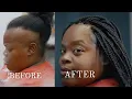 MY CLIENT S STORY Transform Your Life With Alopecia Box Braids