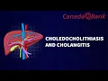Choledocholithiasis Cholangitis Explained Biliary Tract Disorders CanadaQBank