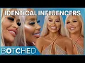 Twinfluencers Dolly and Daisy No Longer Look Identical After Lots of Plastic Surgery Botched E