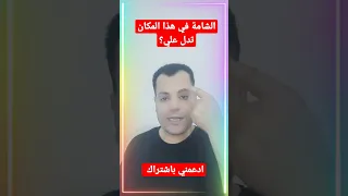اذا كانت الشامه في هذا المكان ماذا تدل فراسة الشامات دندنها