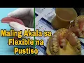 Misconception About Flexible Dentures Maling Akala by DatuAmbasTv