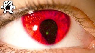 Download Rarest Eye Colours Spotted in Humans MP3