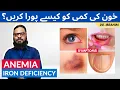 Download Lagu Khoon Ki Kami Ka Ilaj | How To Treat Anemia Iron Deficiency [Urdu/Hindi] Dr. Ibrahim