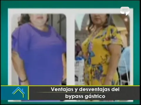 Ventajas y desventajas del bypass gástrico