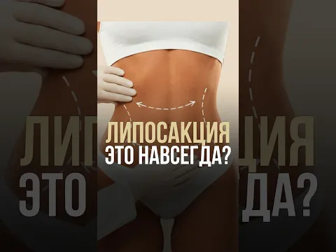Липосакция - это навсегда