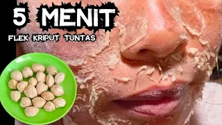 Bumbu Ajaib!! FLEK HITAMMU, KERIPUTMU TUNTAS!! WAJAH LANGSUNG MUDA GLOW UP!!