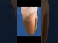 How many roots does a molar have