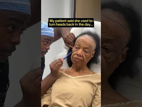 Can I Take Her Back to Her Prime With Plastic Surgery? 🤩 INSANE FACELIFT REVEAL