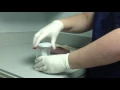 Proper Sputum collection and submission