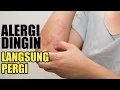Download Lagu Obat alergi dingin paling ampuh,alergi hilang total MP3