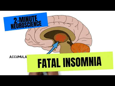 Download MP3 2-Minute Neuroscience: Fatal Insomnia