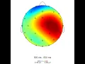 Visualising EEG effects with topographic mapping in BrainVision Analyzer