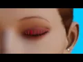 What is blepharitis