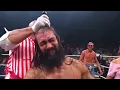 Wheeler Yuta loses his hair at