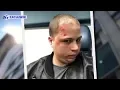 More claims of physical abuse by welfare agency police