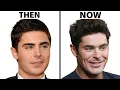 Is Zac Efron s Face All Natural Plastic Surgery Analysis