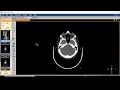 DICOM viewer software the easiest way to review CTs and MRIs on your PC