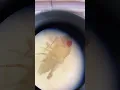 Download Lagu Drosophila Melanogaster under microscope