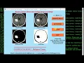Brain Tumor Classification Using Deep Learning Neural Network Python Project With Source Code