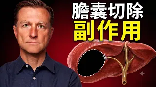 美國每年70萬人切除膽囊！了解醫生沒說的「膽囊切除副作用」與消化系統危機｜柏格醫生 Dr. Berg