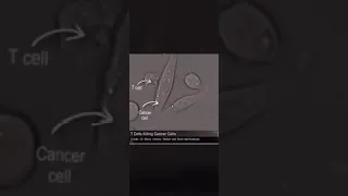 هام جدا جدا شاهد كيف تهاجم خلايا المناعة T Cell الخلايا السرطانية وتقتلها 