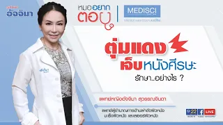  ตุ่มที่หนังศรีษะเจ็บ มักเกิดจากสาเหตุอะไรบ้าง 