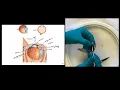 Eye Dissection Instructions