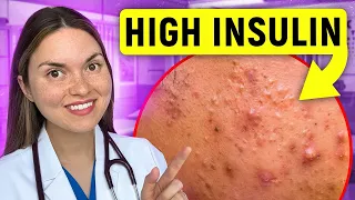 What Your FACE Says About Your HEALTH: Doctor Explains