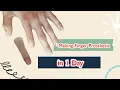 Download Lagu making Finger prosthesis | index finger lost | prosthesis | Custom finger prosthesis