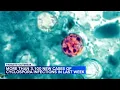 More than 3 100 cyclosporiasis infections reported in last week