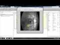 IEEE 2015 MATLAB Sparse Dissimilarity-Constrained Coding for Glaucoma Screening