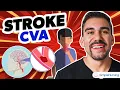 Short Stroke CVA