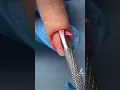 Download Lagu WATCH ME FIX MY CLIENTS NAIL🤢💅🏼(OMG)😳