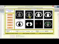 Early Stage Lung Cancer Detection using Image Processing Matlab Project Code