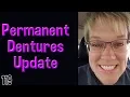 New Teeth from Affordable Dentures - Permanent Dentures