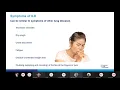 Understanding Interstitial Lung Disease