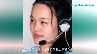 chinese amputee girl yuqing