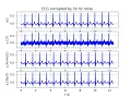 Digital Signal Processing Using Python Chapter 8 Part1