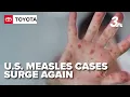 Health s stress MMR vaccine s effectiveness as measles cases rise in U S