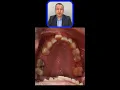 Download Lagu Neglect to Renewal: Teeth Cleaning