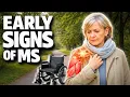 7 Early Signs of Multiple Sclerosis You Should Never Ignore Millions Have MS And Don t Know It