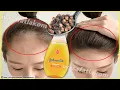 Download Lagu Put these ingredients in your shampoo, 🌾 it accelerates hair growth and treats baldness