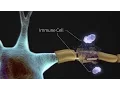 What is Multiple Sclerosis