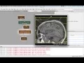 How to Use CLI Modules in MeVisLab