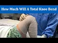 Hoeveel buigt een totale knie? De volledige bewegingsvrijheid van een knieprothese benutten