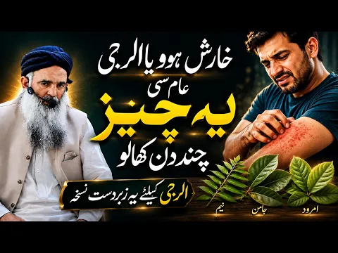 Allergy Ka Asan Ilaj | Dr Sharafat Ali | Chand Din Neem Ke Pattay Istemal Karein | Zabardast Nuskha